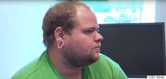 GRAPHIC IMAGES: Guy Gets Stretched Earlobes Sewn Up In Gruesome Surgery