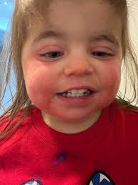 A useful read for anyone who is either coeliac or also affected by WHEAT—  remember also that CERAMIDES can also be produced from CORN!