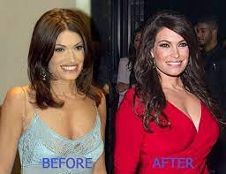 The only logical reasons that kimberly guilfoyle is dating doofus . Kimberly Guilfoyle Plastic Surgery Rumors Before And After Pictures Comparison Glamour Path