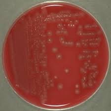 We did not find results for: Clostridium Perfringens