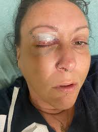 Warning: This story contains graphic images.