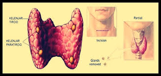 We did not find results for: Sistem Endokrin Pengertian Fungsi Kelenjar Endokrin Dan Gambar