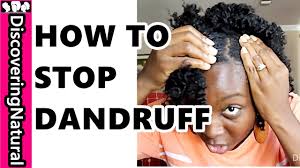 How to treat dandruff naturally. How To Get Rid Of Dandruff Fast Dandruff Treatments For Natural Hair Youtube