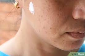 4 Ways To Apply Toothpaste On Pimples Wikihow
