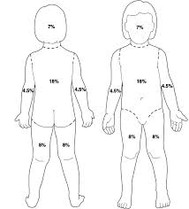 rules of nines chart rule of nines chart child lund and