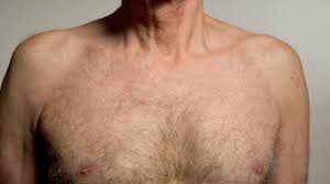 Treatment for breast cancer in men. Male Breast Cancer How To Spot The Symptoms Plus What Happens After Diagnosis Huffpost Uk Life