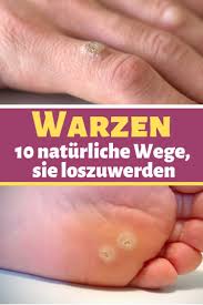 97 Warzen Ideen In 2021 Hausmittel Gesundheit Warzen Hausmittel