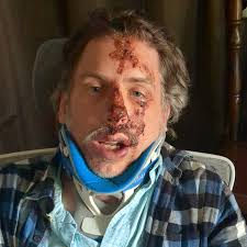 Fundraiser by Naomi Karczewski : Join Naomi in Supporting Nathan's Recovery