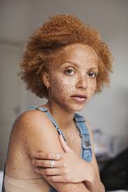 Tips Tricks New Milk Makeup With Coral Kwayie Urban Outfitters Blog Women With Freckles Beautiful Freckles People With Freckles