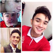 Mads Skin Care System