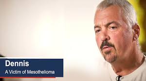 Mesothelioma is a rare form of cancer found in the lining of the chest and lung. Mesothelioma Lawyer Connect With An Attorney Today