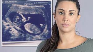 I lost my unborn baby after docs mistook my diabetes for pregnancy  cravings'