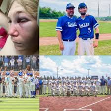 The pics of true grit!💪🏽On April 12th, Appalachian High School Baseball  Senior Chris Heekin suffered a broken nose, broken maxillary sinus, and  fractured orbital during a game. He was determined to continue