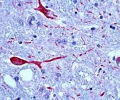 Oreste teodorescu mobilizare pentru protest alerta de gradul 0 fiți pregătiți sa apărăm românia. AlertÄƒ De Gradul Zero 23 De Cazuri De InfecÈ›ie Cu Virusul West Nile Un BÄƒrbat A Murit Evenimentul Zilei