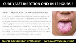 Can a yeast infection be treated? How Long Does S Yeast Infection Last 3 Days Aqhd Deti Vetra Ru