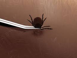 Image result for Tick Removal