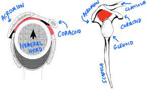 Shoulder Impingement 3 Keys To Assessment And Treatment Mike Reinold