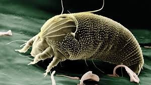 Man macht sich einfach mehr gedanken bei dieser bezeichnung. Hausstaubmilben Im Schlafzimmer Tipps Bei Allergie