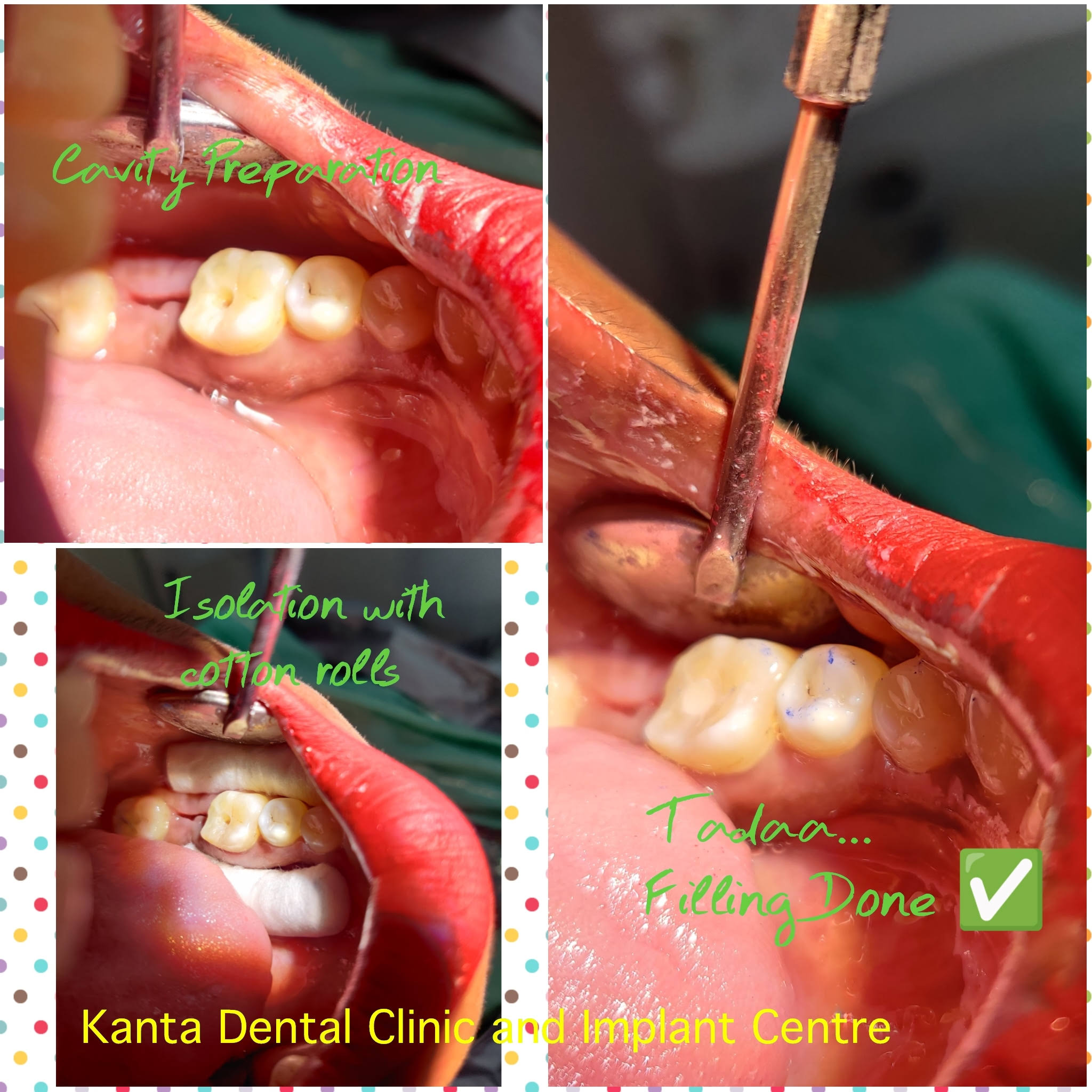 Teeth Restoration product image