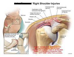 Posted on december 13, 2018december 12, 2018. Shoulder Diagram 2010 In 2021 Shoulder Injuries Shoulder Joint Health And Wellness