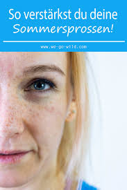Sommersprossen oder epheliden (altgriechisch ἔφηλις. 5 Tipps Wie Du Deine Sommersprossen Verstarken Kannst We Go Wild
