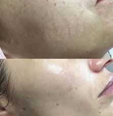Smooth, repaired, lightened, lifted, firmened and detoxified skin. Bb Glow Go Smetics In Munchen Neuhausen