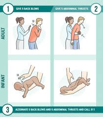 Cpr And Choking First Aid Basics Simple Family Preparedness Choking First Aid First Aid First Aid Cpr