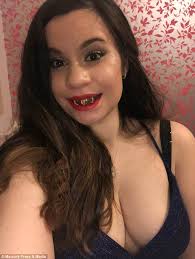 Holly Everson-Bullock has jaw realigned after underbite left her unable to  eat