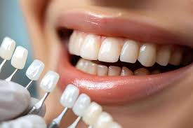 How Cosmetic Dentistry Can Change Your Life