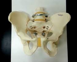 The anterior superior iliac spine (asis) is the most anterior part of the iliac crest. Accuracy Of Anterior Superior Iliac Spine Symmetry Assessment By Routine Structural Examination