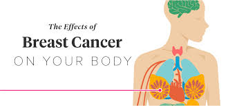 Facts about the most common cancer symptoms and signs, which include lumps what are 18 signs and symptoms of cancer? 12 Effects Of Breast Cancer On The Body