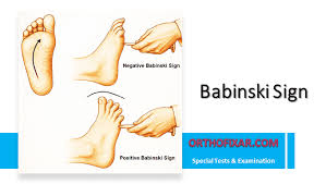 Image result for Babinski Reflex