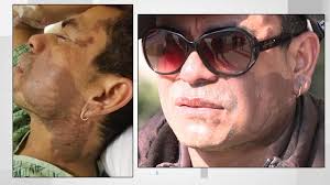 Doctor to examine competency of man accused in acid attack