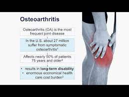 Osteoarthritis: Prevention Detection And Treatment - Youtube
