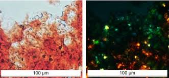 A belgian neuropathologist studying degenerative changes in aging brains rst noted the characteristic green birefringence of amyloid substance when stained with congo red and. Scientists Find Functioning Amyloid In Healthy Brain Eurekalert Science News