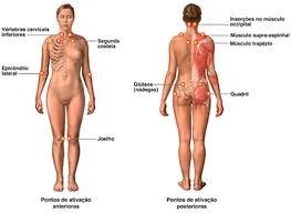 El dolor asociado con la fibromialgia muchas veces se describe como un dolor leve. Moda Preta Porte Sintomas E Tratamentos Da Fibromialgia