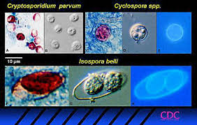 Image result for Cyclospora