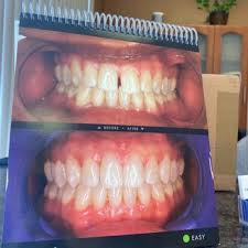 Sherman oaks dentist, olivia s cajulis dds inc is a local, trusted dental practice offering general and cosmetic dentistry, teeth whitening, implants, veneers & other dental care. Comfort Care Dental 41 Photos 104 Reviews General Dentistry 5151 Hazeltine Ave Sherman Oaks Ca Phone Number