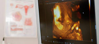 Praenatalschall de practice for prenatal diagnostics in munich. 3d 4d Ultraschall Ermoglicht Plastische Darstellung Des Kindes