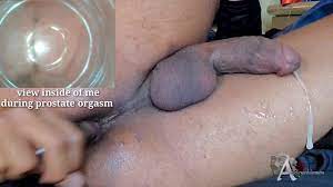 Prostate cumming