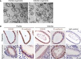 Frontiers | Infertile human endometrial organoid apical protein secretions  are dysregulated and impair trophoblast progenitor cell adhesion