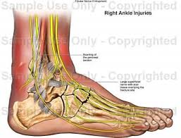 Pin On Feet Pain And Swelling