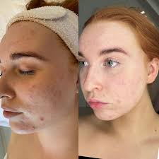 ABOUT Tahu Skin Clinic