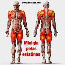 Resultado de imagem para dores musculares após atividade física