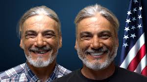 America's Choice Full-Mouth Dental Implants