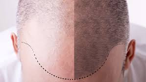 Just visit the usps website to learn how to find a post office near you. Trapianto Capelli Mg Beauty Service