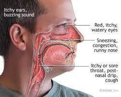 Hay Fever In March Is A Real Blow Essex London Ent