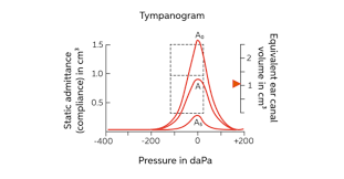 Image result for Tympanometry