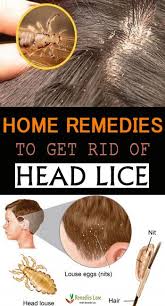 Home Remedies To Get Rid Of Head Lice Headlice Head Lice Remedy Https Www Remedieslore Com Home Rem Lice Remedies Head Lice Remedy Home Remedies For Acne