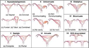 Amh hormone level can be measured at any point of a woman's menstrual cycle with an amh blood test. Role Of Three Dimensional Transvaginal Sonography Compared With Magnetic Resonance Imaging In Diagnosis Of Mullerian Duct Anomalies Egyptian Journal Of Radiology And Nuclear Medicine Full Text